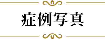 症例写真
